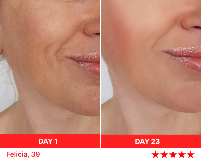 light therapy day 23