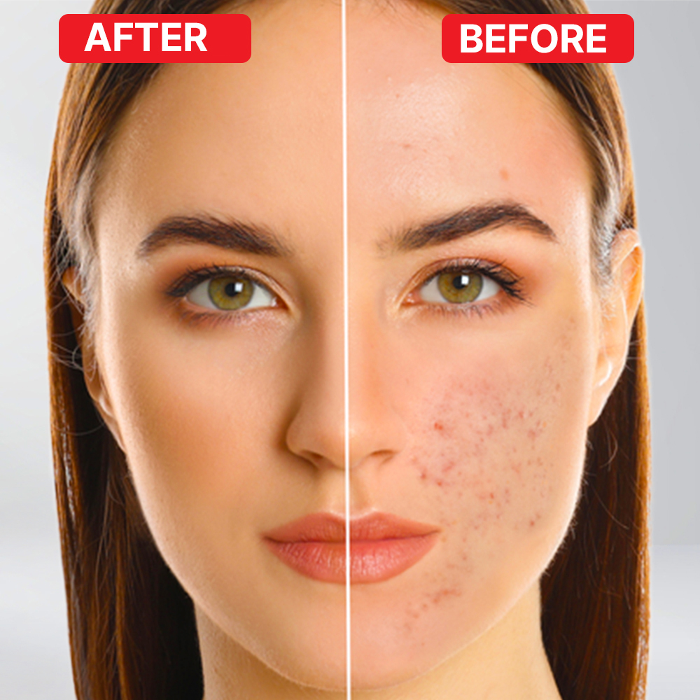 red-light-therapy-skin-benifits